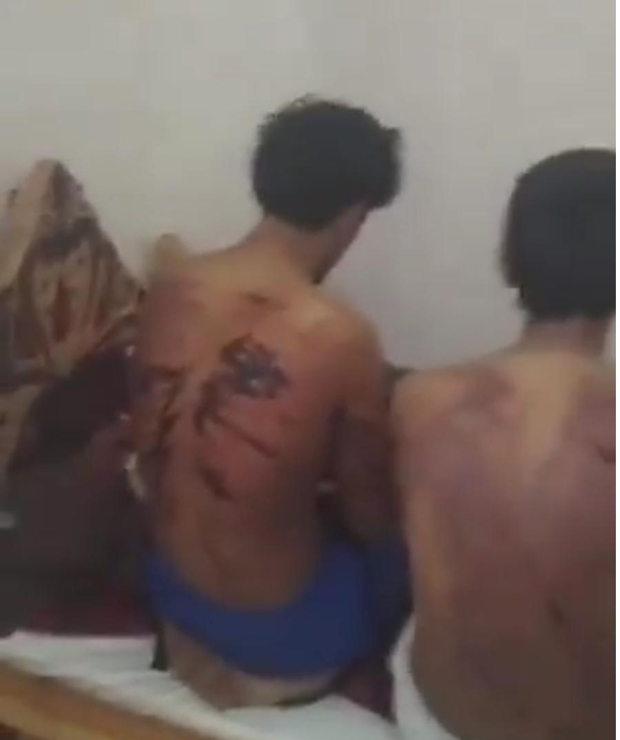 ما هي صحة ادعاءات تعذيب يمنيين في سلطنة عمان بعد ظهور الفيديو؟